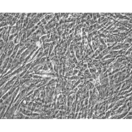 Human Primary Oviduct Epithelial Cells