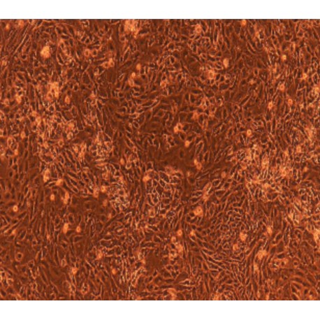 Human Primary Endometrial Epithelial Cells