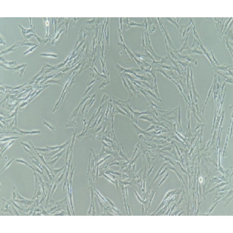 Human Primary Uterine Smooth Muscle Cells