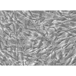 Human Primary Mammary Fibroblasts Cells