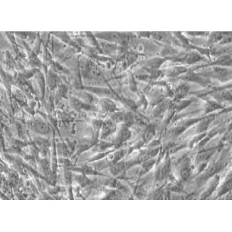 Human Primary Mammary Fibroblasts Cells