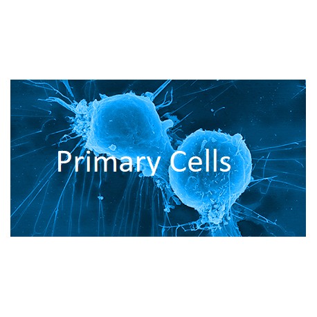Human Primary Breast Tumor Cells