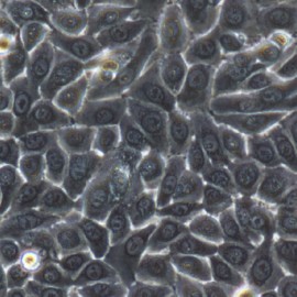 Human Primary Keratinocytes Cells