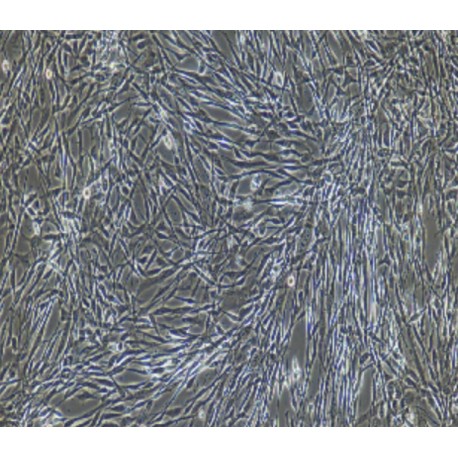 Human Primary Adipose Microvascular Endothelial Cells