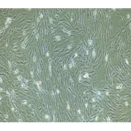 Human Primary Ligament Fibroblasts Cells