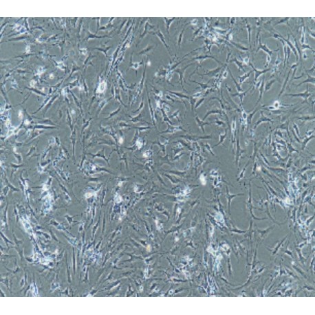 Human Primary Rheumatoid Arthritis Synovial Fibroblasts Cells