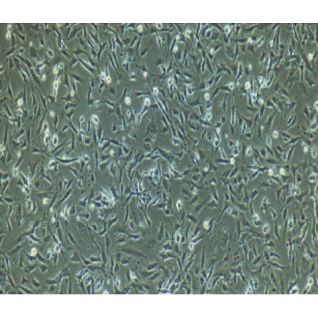 Human Primary Endothelial Progenitor Cells