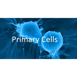 Human Primary Splenic Stellate Cells