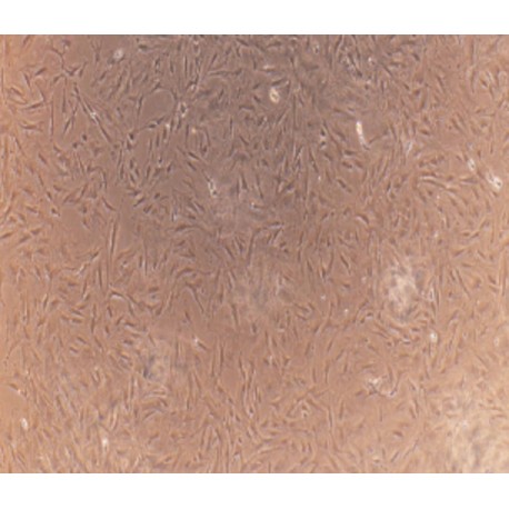 Human Primary Periodontal Ligament Stem Cells