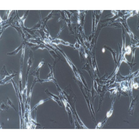 Human Primary Retinal Microvascular Endothelial Cells