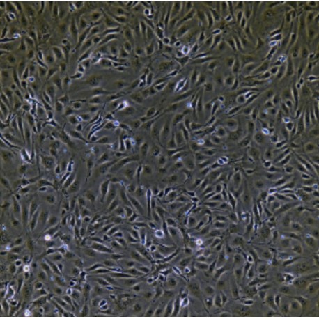 Human Primary Umbilical Vein Endothelial Cells