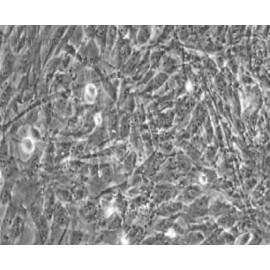 Human Primary Umbilical Artery Endothelial Cells