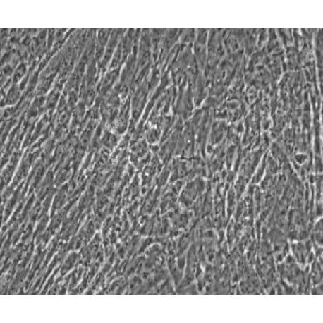 Human Primary Umbilical Vein Smooth Muscle Cells