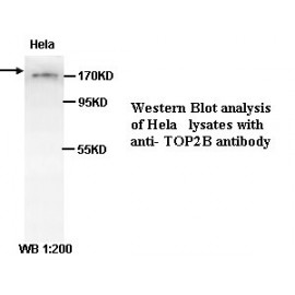 TOP2B Antibody (Rabbit Polyclonal)