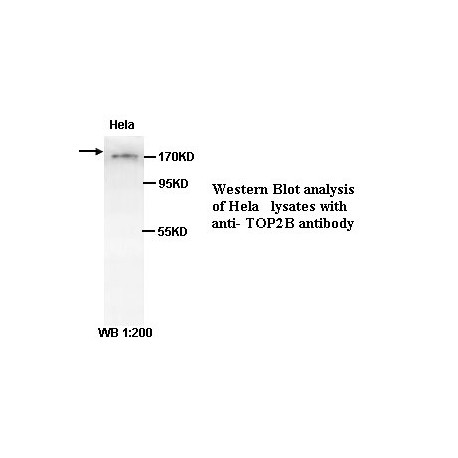 TOP2B Antibody (Rabbit Polyclonal)