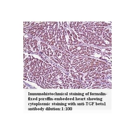 TGF beta1 Antibody (Rabbit Polyclonal)