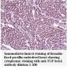 TGF beta1 Antibody (Rabbit Polyclonal)