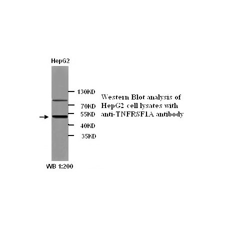 TOP2B Antibody (Rabbit Polyclonal)