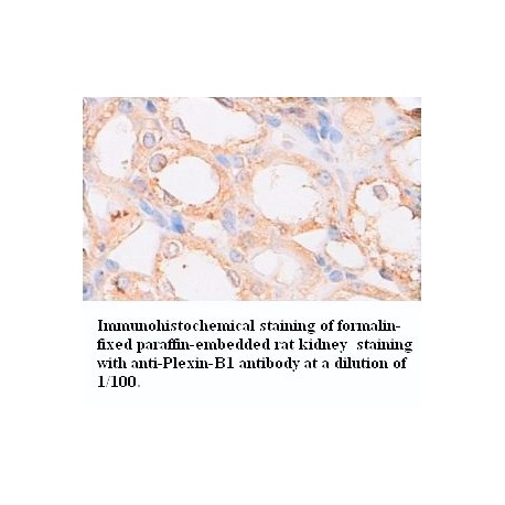 Plexin-B1 Antibody (Rabbit Polyclonal)