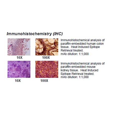 Rabbit anti-human Creatine kinase-MB (CKMB) monoclonal antibody, clone 8F1