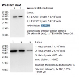Rabbit anti-human Creatine kinase-MB (CKMB) monoclonal antibody, clone 8F1