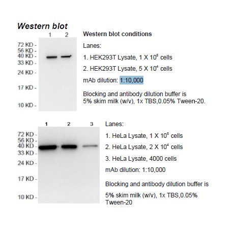 Rabbit anti-human Creatine kinase-MB (CKMB) monoclonal antibody, clone 8F1