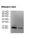 Rabbit anti-human Chemokine (C-C motif) ligand 18 (CCL18) monoclonal antibody, clone 5G8