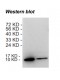 Rabbit anti-human Chemokine (C-C motif) ligand 18 (CCL18) monoclonal antibody, clone 12B9