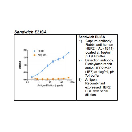 Rabbit anti-human HER2 Monoclonal Antibody Clone 1B11