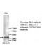 TNFRSF10D Antibody (Rabbit Polyclonal)