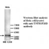 TNFRSF10D Antibody (Rabbit Polyclonal)