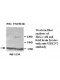 UBE2V2 Antibody (Rabbit Polyclonal)