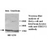UBE2V2 Antibody (Rabbit Polyclonal)