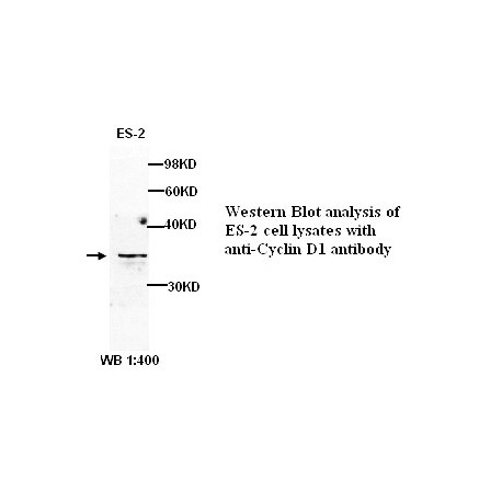 CCND1 Antibody (Rabbit Polyclonal)