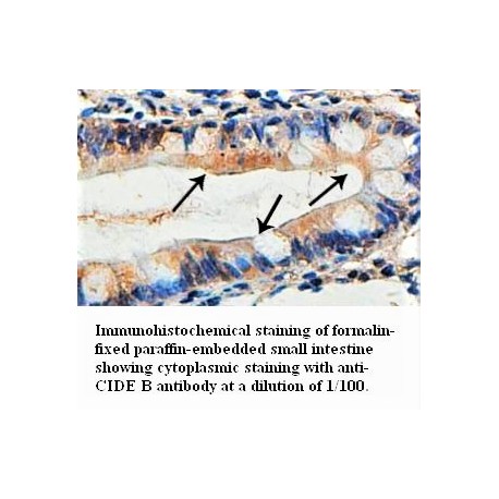 CIDEB Antibody (Rabbit Polyclonal)