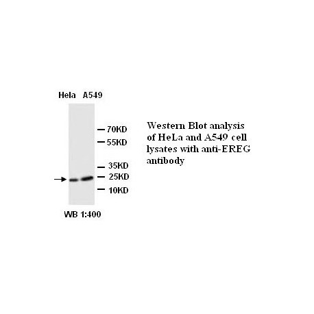 EREG Antibody (Rabbit Polyclonal)