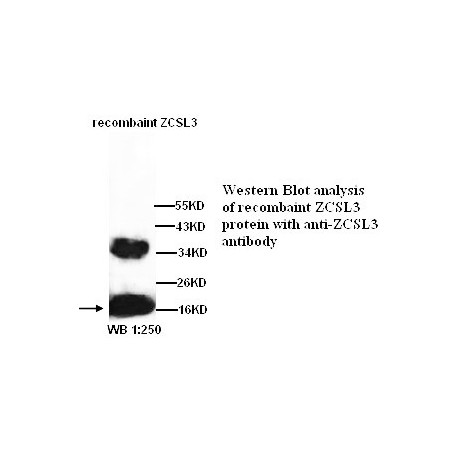 ZCSL3 Antibody (Rabbit Polyclonal)