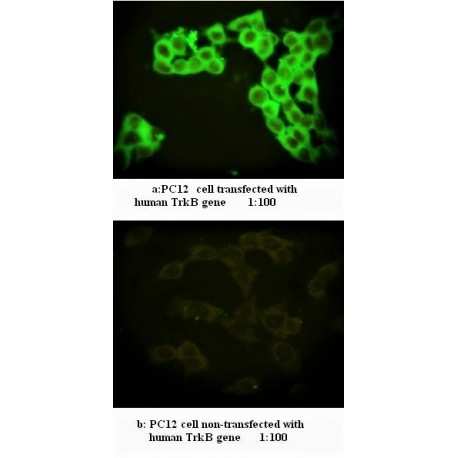 TRKB Antibody (Rabbit Polyclonal)