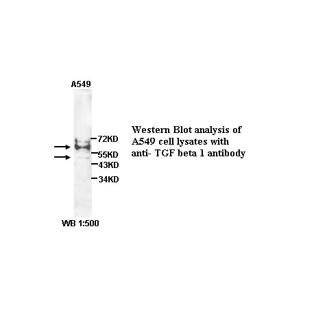 TGF beta1 Antibody (Rabbit Polyclonal)