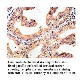  ADRA1D Antibody