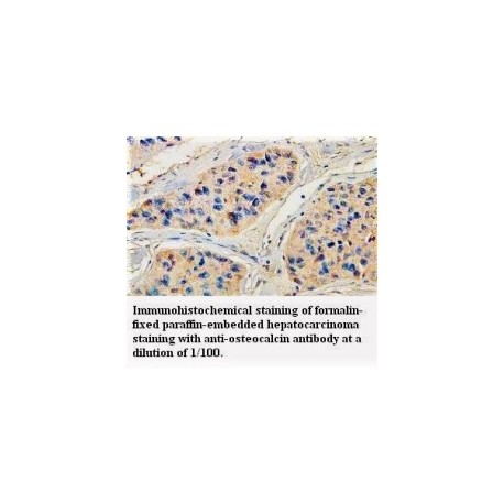 osteocalcin Antibody