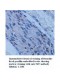 TdT Antibody