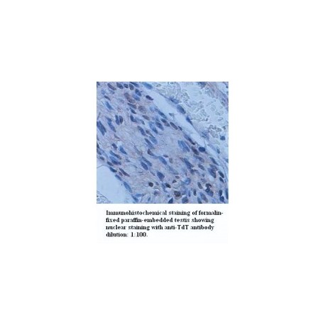  TdT Antibody