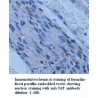 TdT Antibody