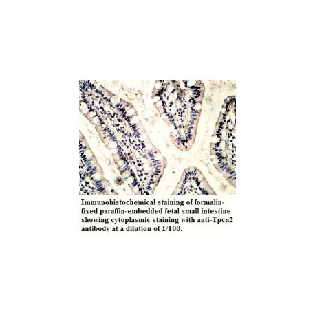  TPCN2 Antibody