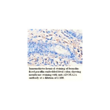  ADORA2A Antibody