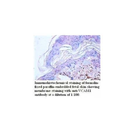  VCAM1Antibody
