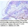 VCAM1Antibody