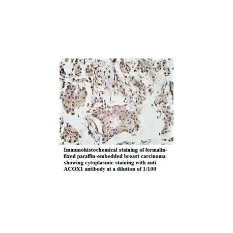  ACOX1 Antibody