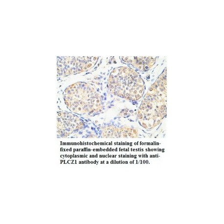  PLCZ1 Antibody